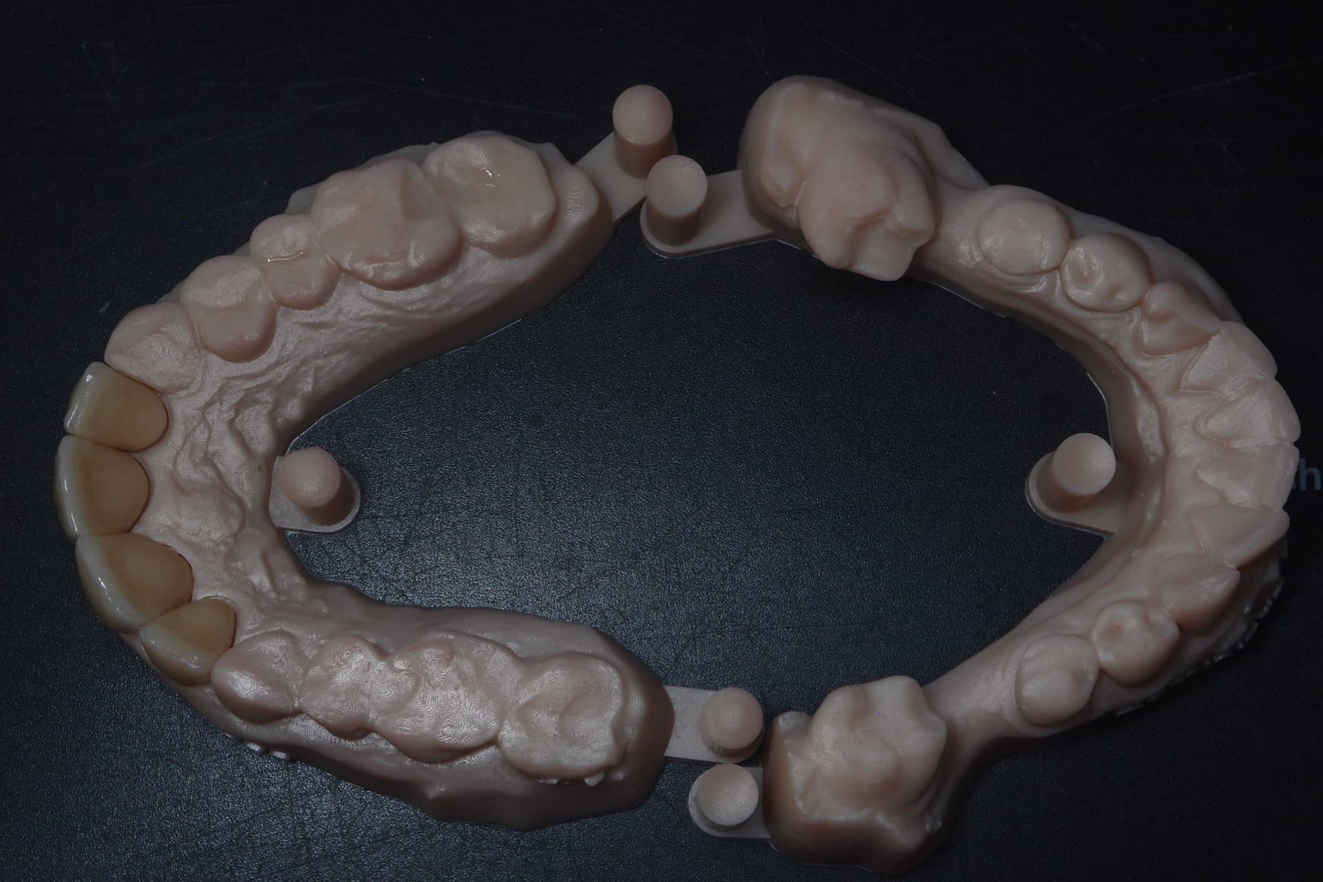 CAD-CAM – Laboratoire Schaack