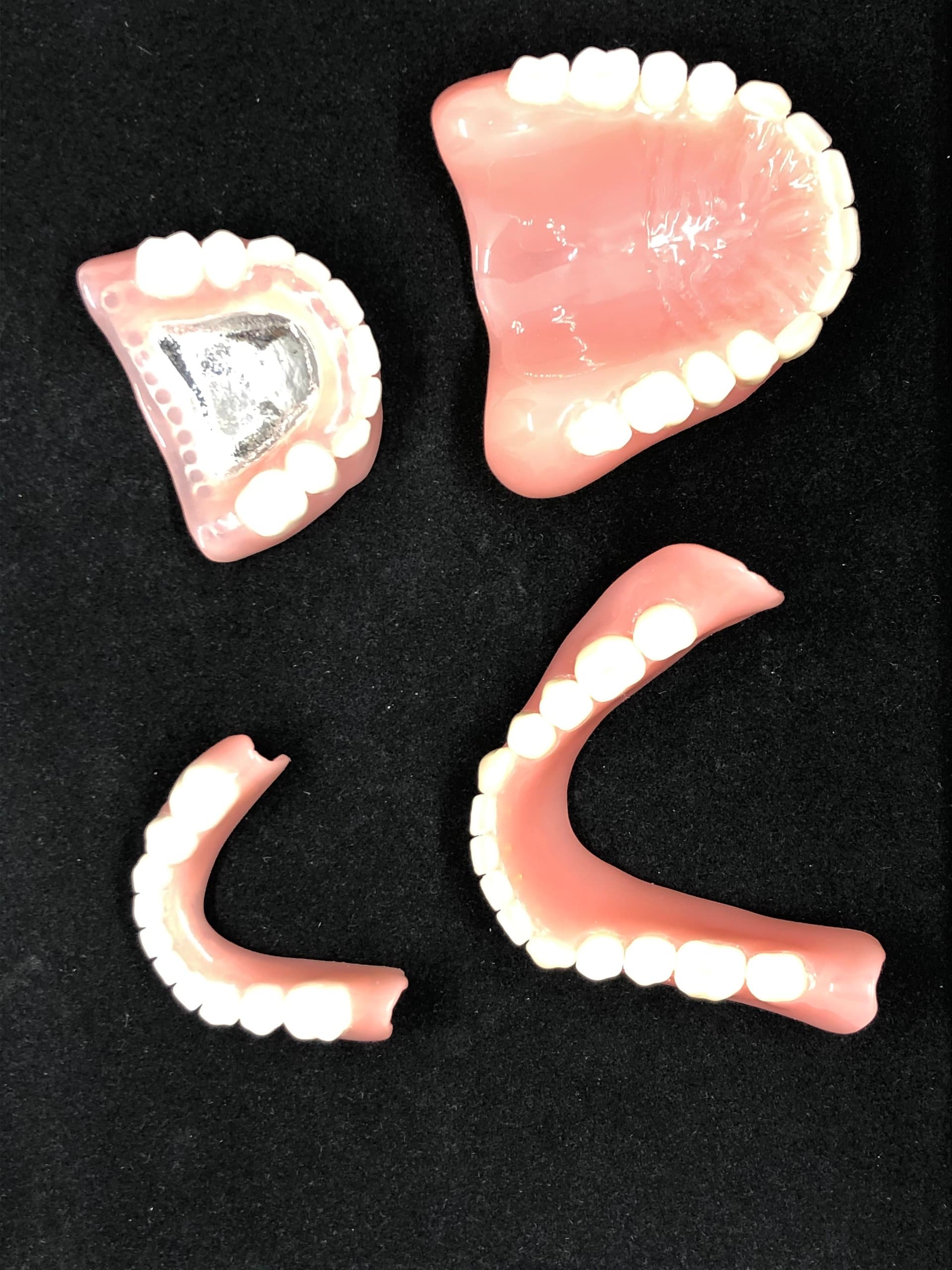Herausnehmbarer Zahnersatz – Laboratoire Schaack