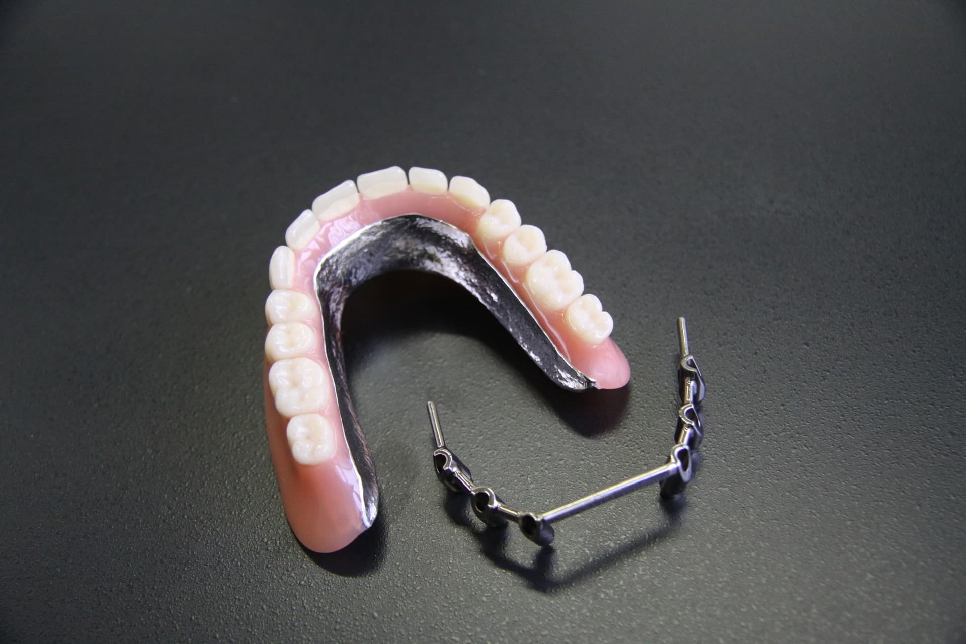 Implantatprothetik – Laboratoire Schaack