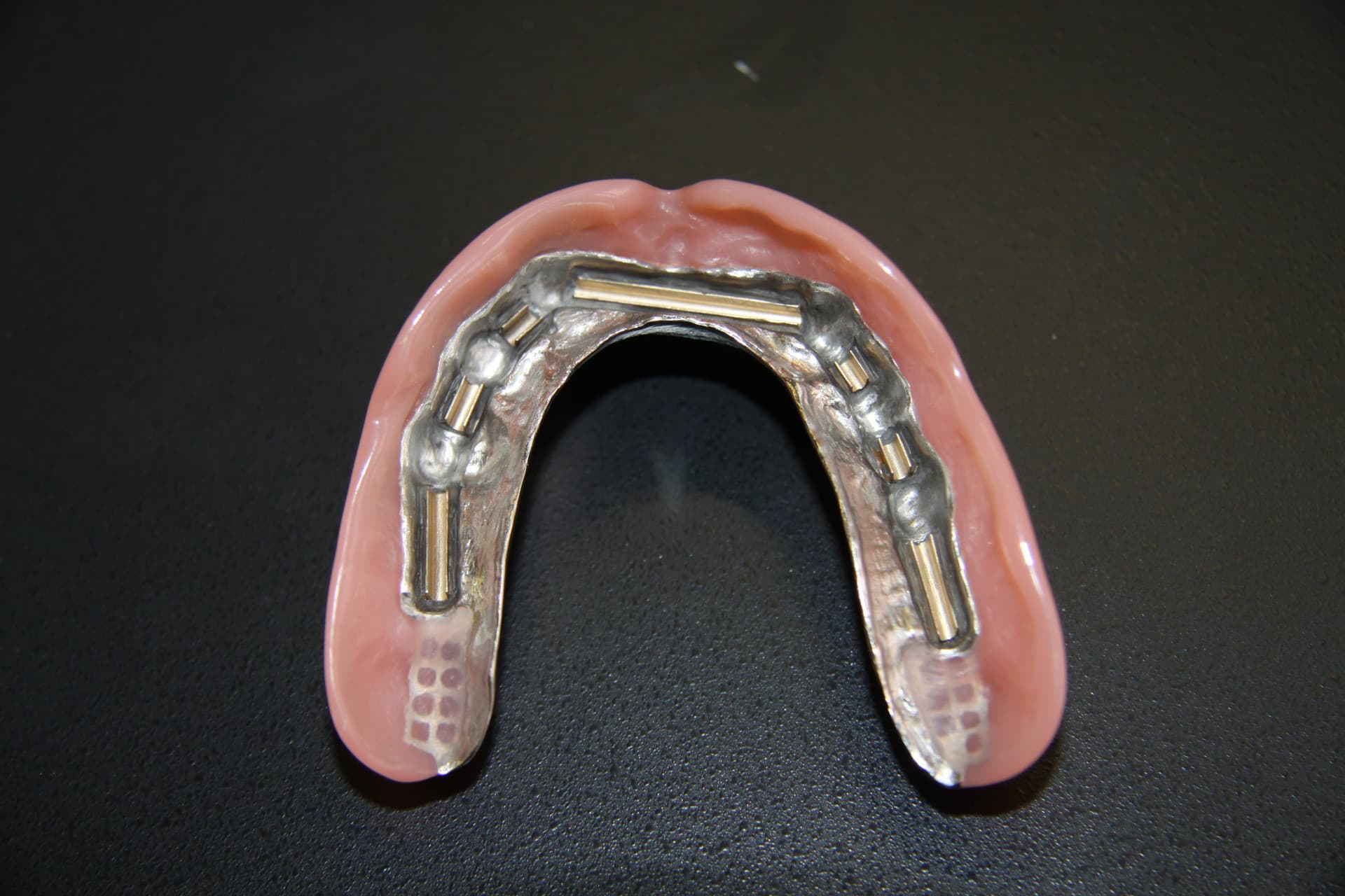 Implantatprothetik – Laboratoire Schaack