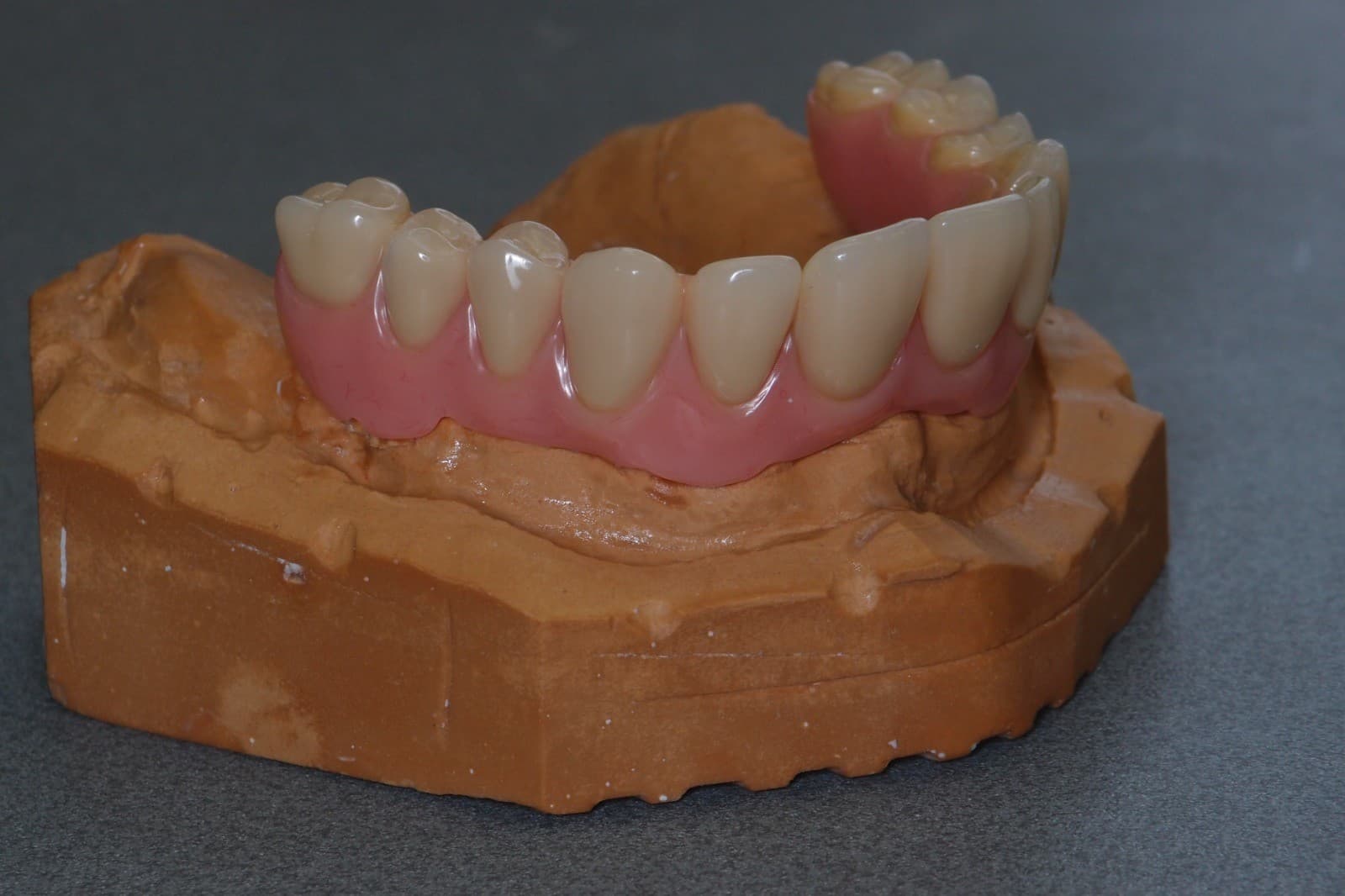 Implantatprothetik – Laboratoire Schaack