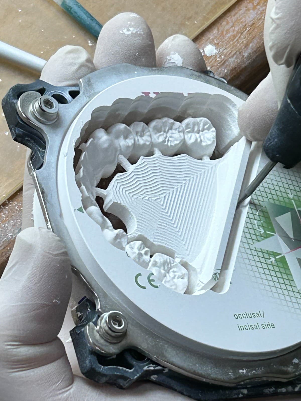 CAD-CAM – Laboratoire Schaack