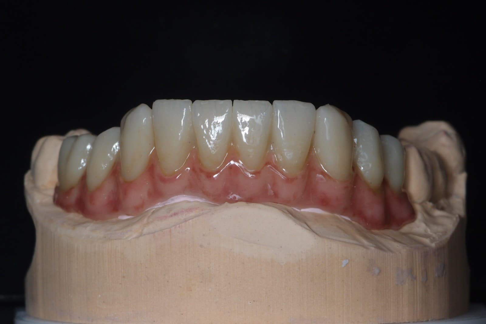 Implantatprothetik – Laboratoire Schaack